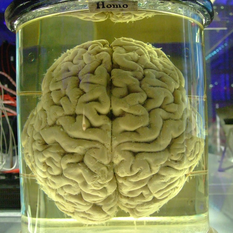 cerebro sistema nervioso